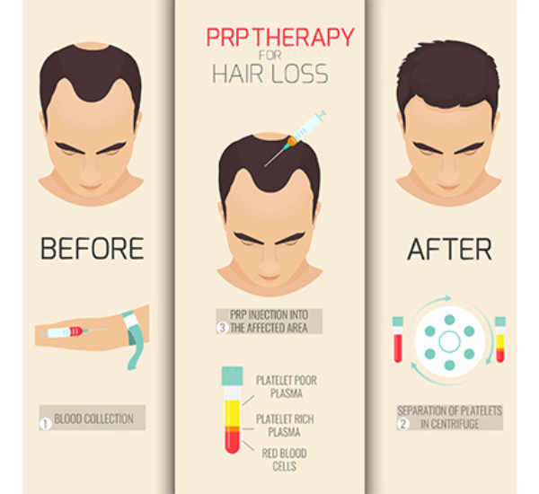 Best Hair Treatment Clinic in Patna