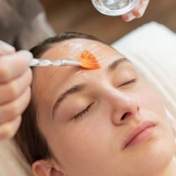 chemPeel chemPeel