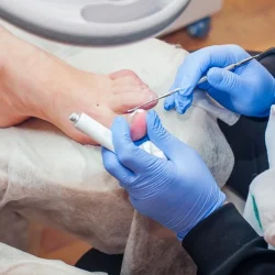 nailsurgery nailsurgery