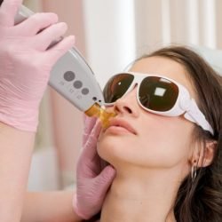 qlaser qlaser
