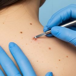 skinbio skinbio