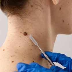 skinbiospy skinbiospy